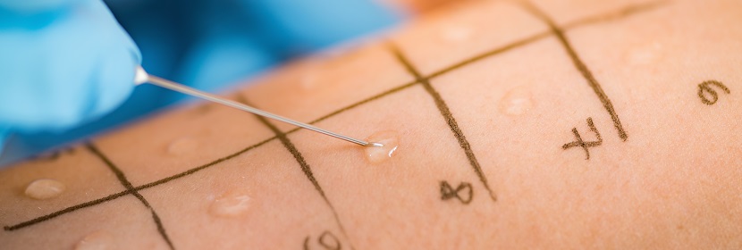 化學(xué)品皮膚致敏試驗